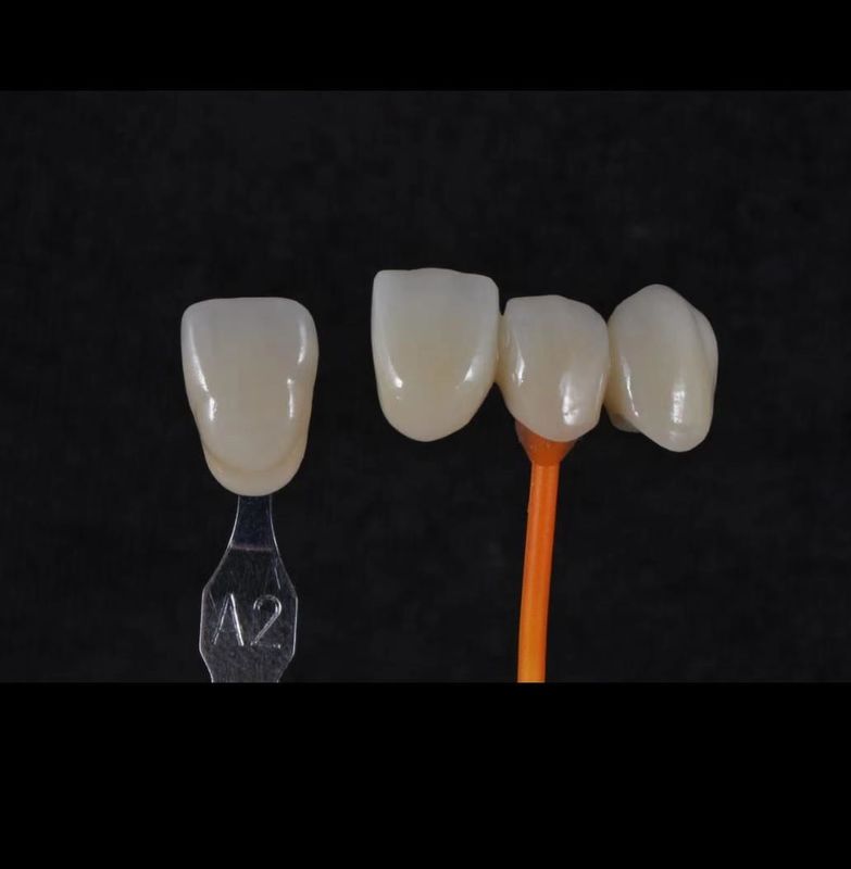 3D Pro Zirkonia Dental Weiß CAD CAM Block 98/95/92mm Offenes System CE