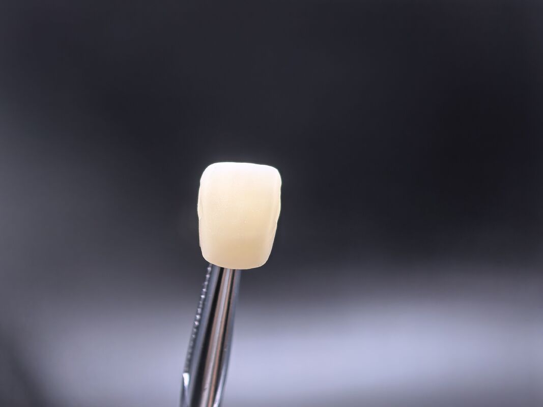 Dental-Zirkonblock kompatibel mit CAD/CAM-Systemen, der mehrere Farbtöne und eine schnelle Verarbeitung für anteriore Zahnrestaurationen bietet